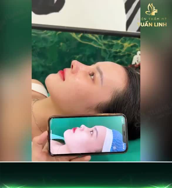 Chỉ 10 ngày thay đổi toàn diện từ gương mặt cho đến thần thái.